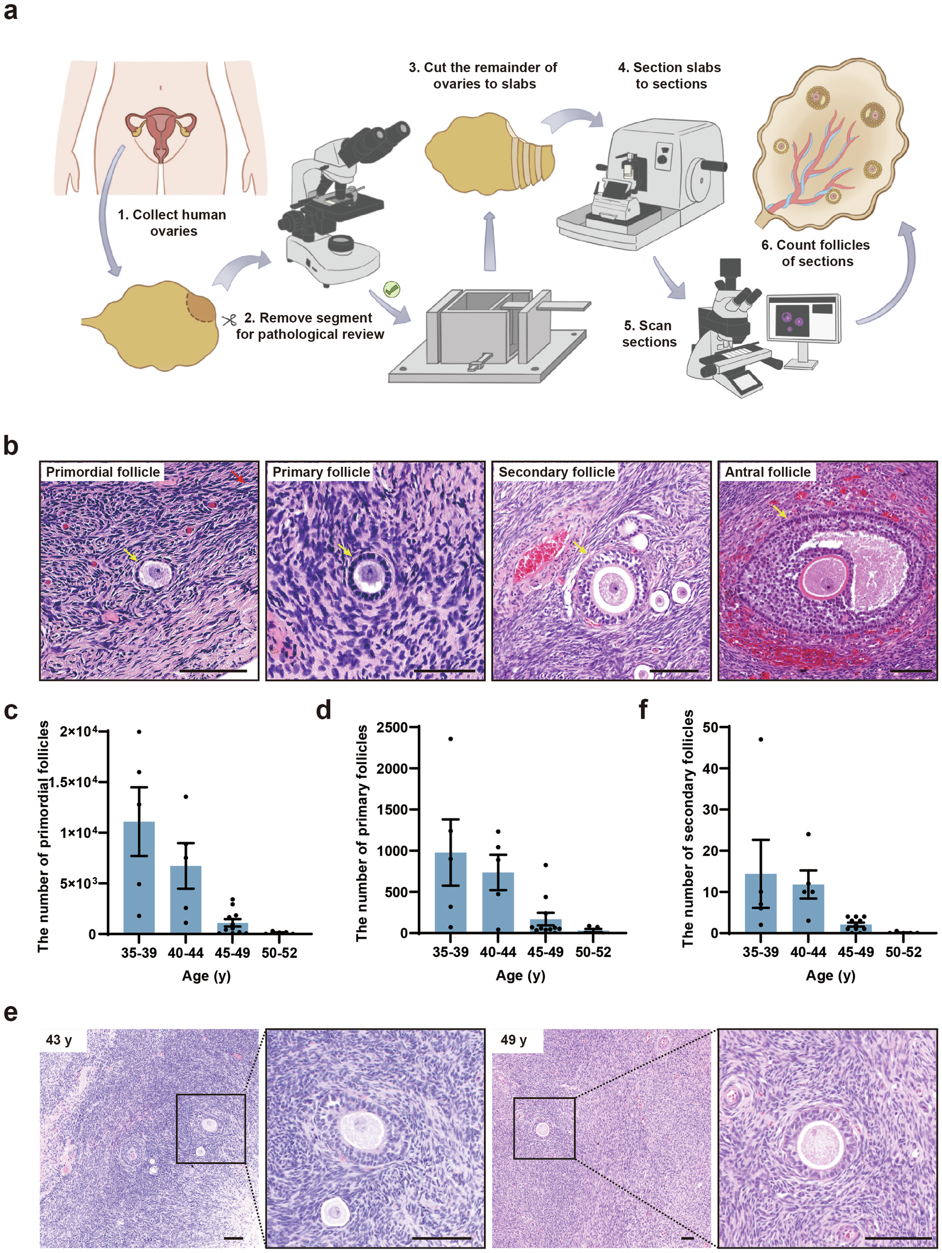 Fig. 1: The ovarian reserve in perimenopausal Chinese women.