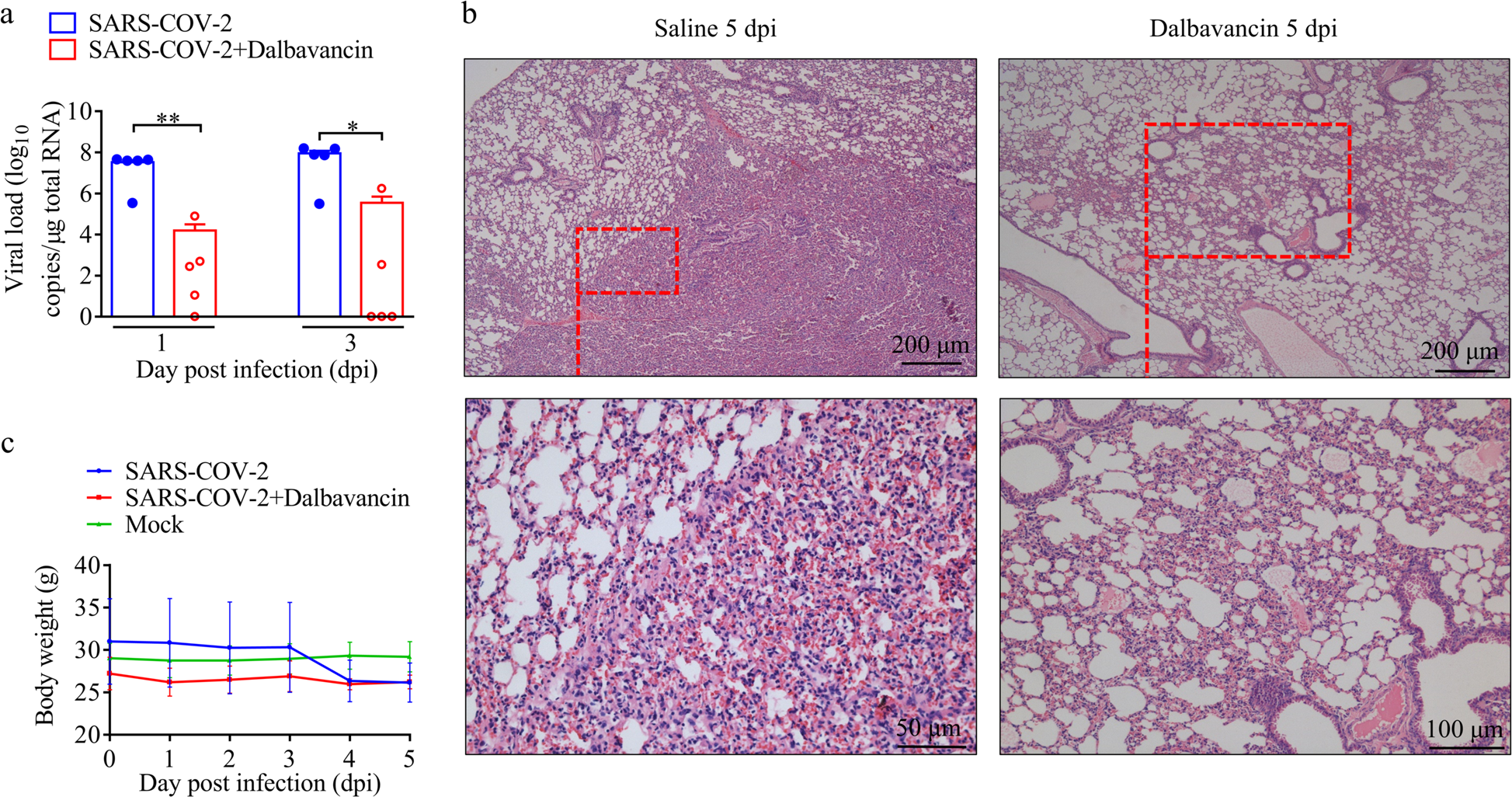 Fig. 4: Dalbavancin inhibits SARS-CoV-2 replication and alleviates pneumonia in hACE2 mice.