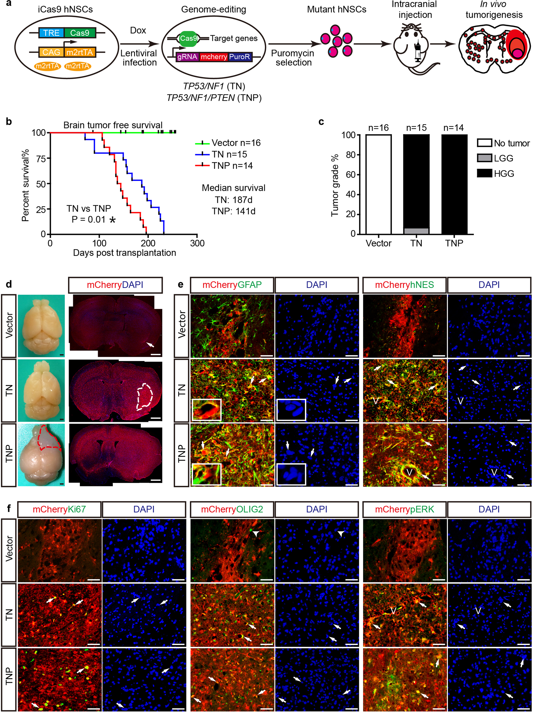 Fig. 1: TN and TNP hNSCs generate HGGs in vivo with high penetrance.