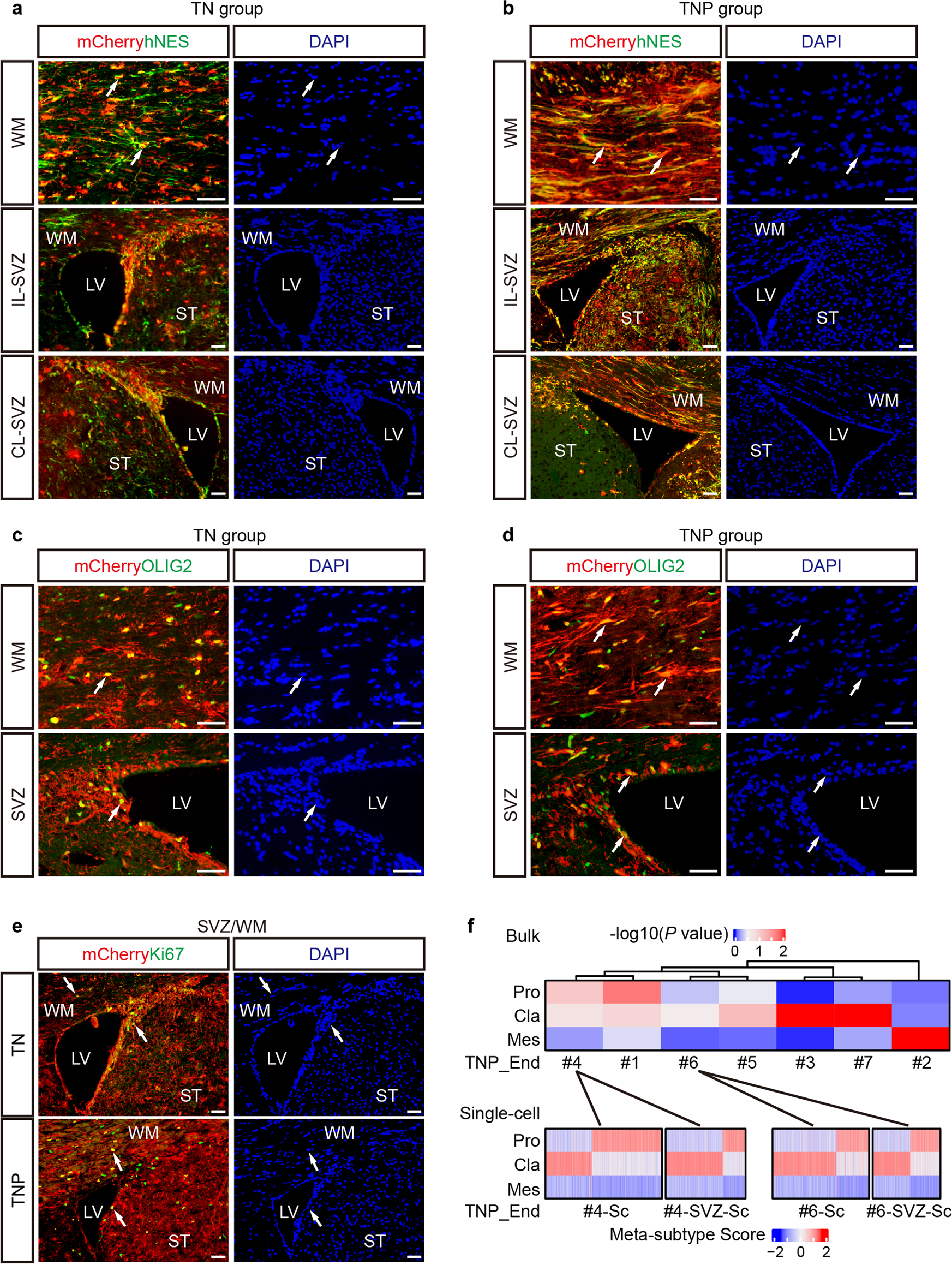 Fig. 2: TN and TNP tumors histologically and transcriptionally resemble human GBM.