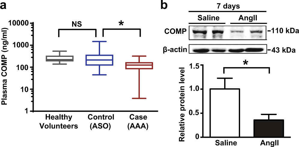 Fig. 1: COMP is downregulated in both AAA patients and mice.