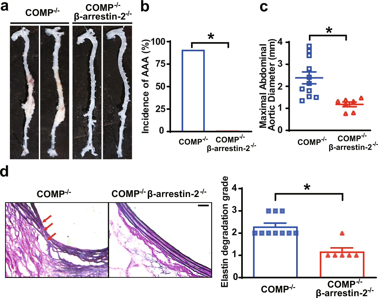 Fig. 6: β-Arrestin-2 mediates the pathological activation of the AT1 receptor aggravated by COMP deficiency.
