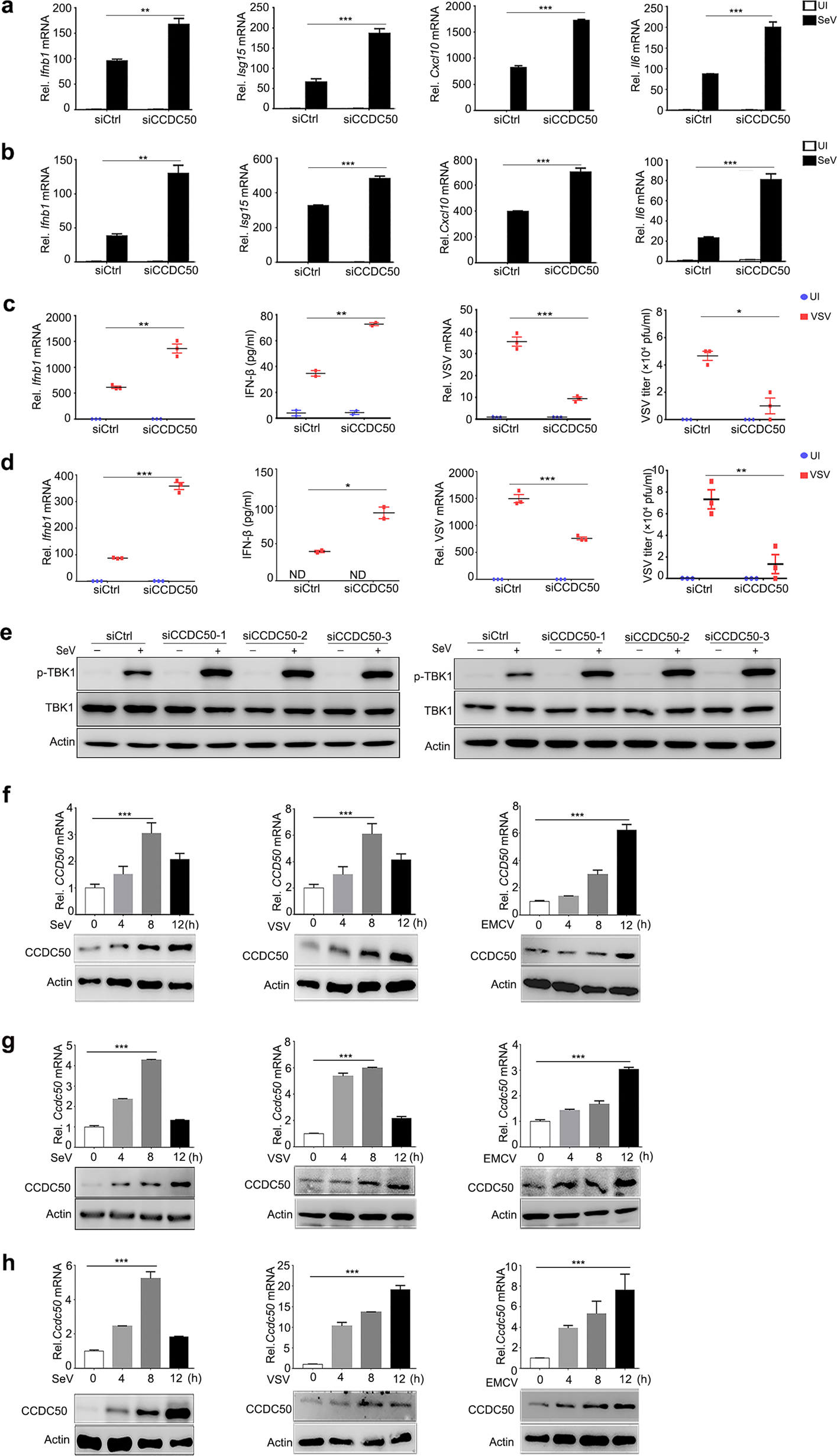 A novel selective autophagy receptor, CCDC50, delivers K63  polyubiquitination-activated RIG-I/MDA5 for degradation during viral  infection | Cell Research
