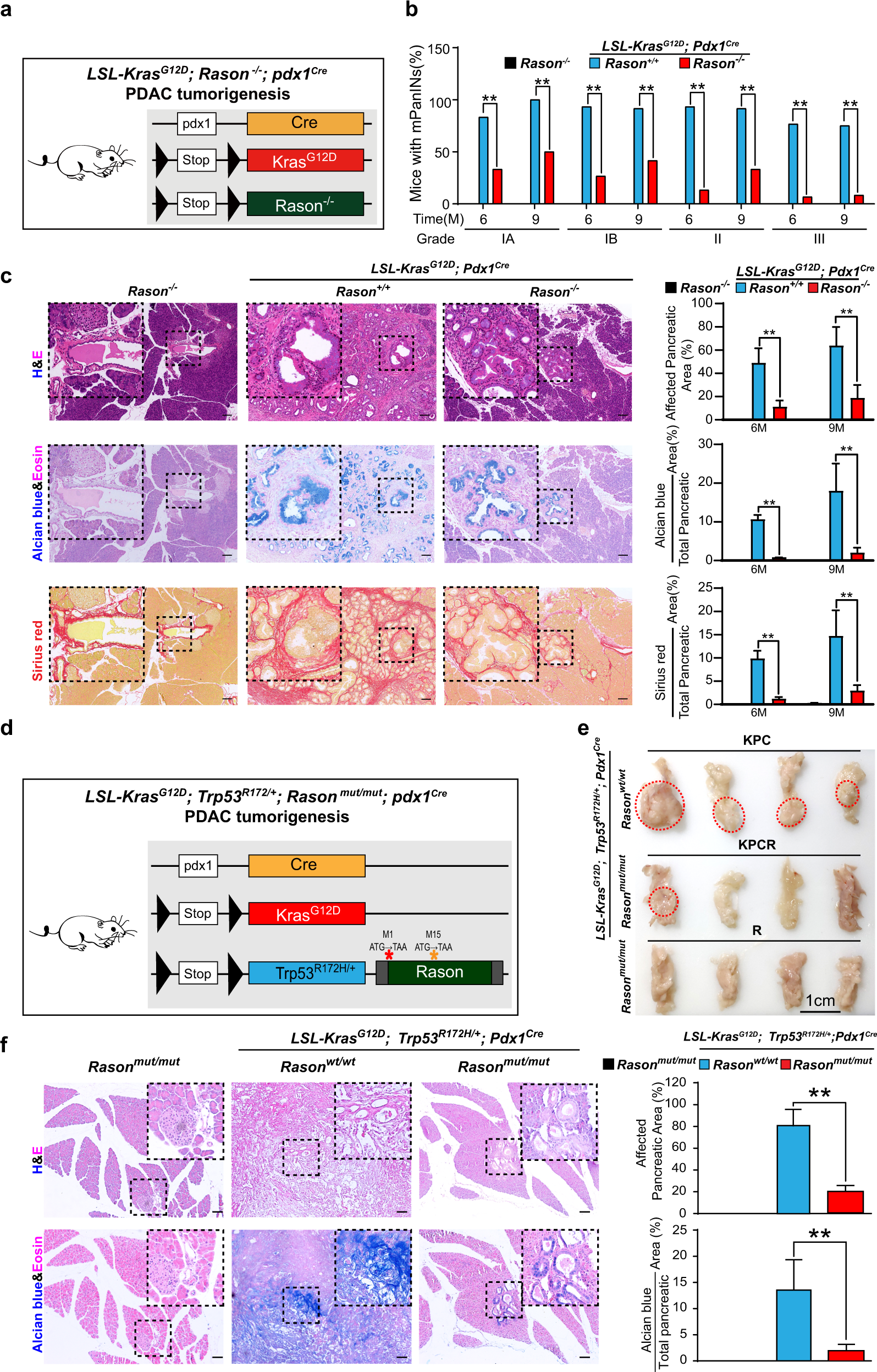 Fig. 4: RASON is required for KRAS-driven pancreatic tumorigenesis.