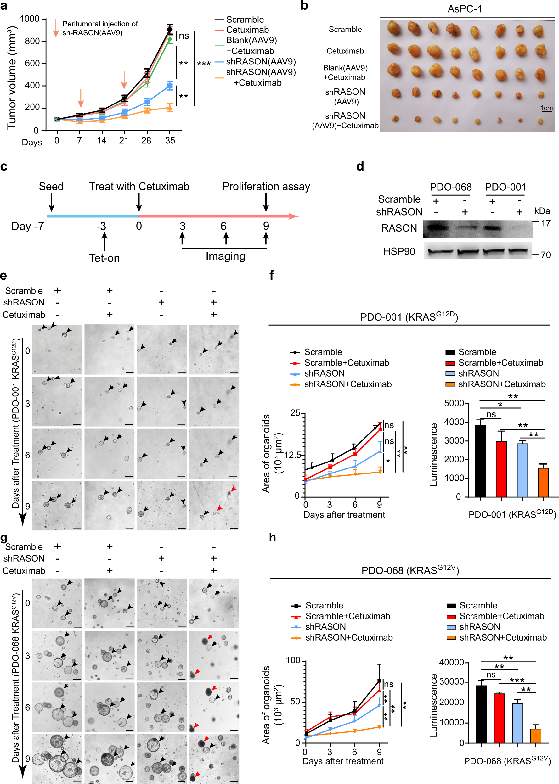 Fig. 7: RASON is a potential target for PDAC therapy.