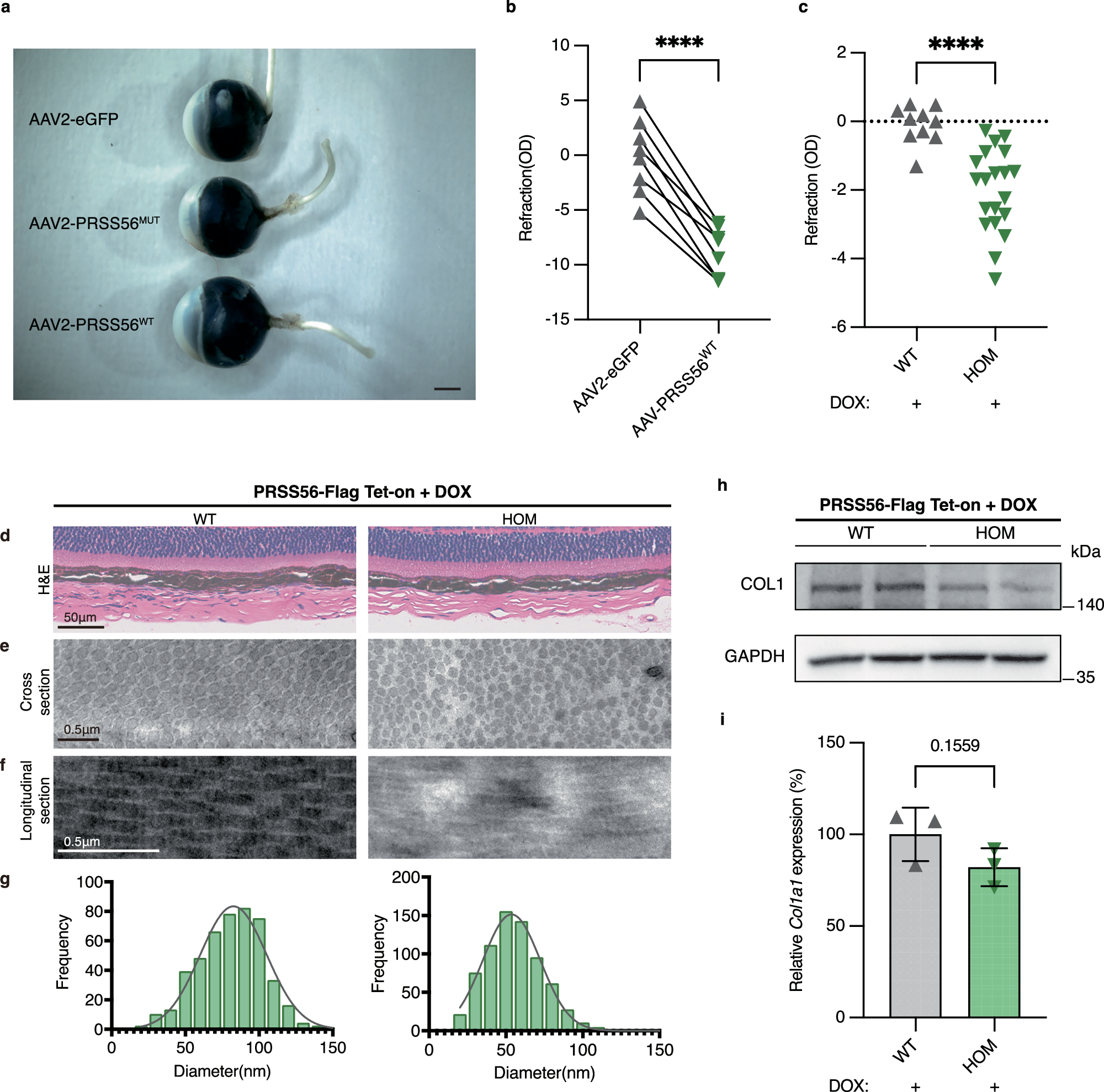 Fig. 4: Morphological changes in the retina and sclera of PRSS56-overexpressing mice.