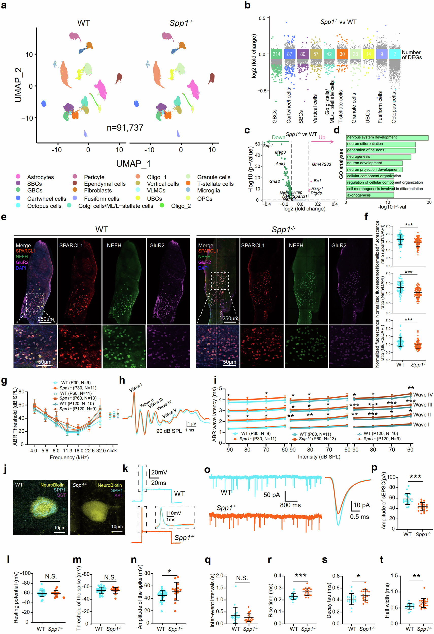 Fig. 5: Spp1 is required to maintain the normal function of the Spp1+ bushy cells.