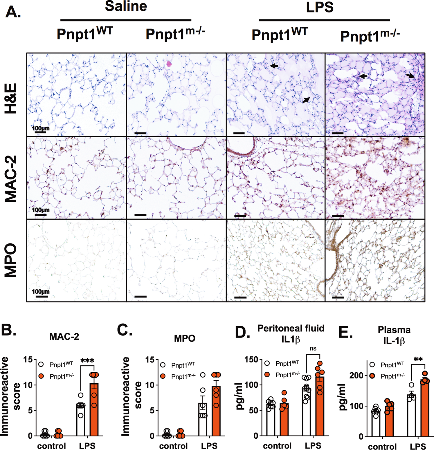 Pnpt1 mediates NLRP3 inflammasome activation by MAVS and metabolic  reprogramming in macrophages | Cellular & Molecular Immunology