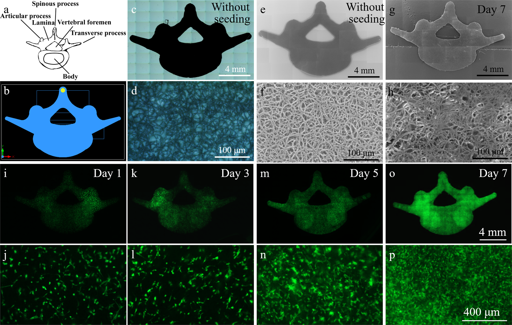 Fig. 5: Lumbar spine-like scaffold design and cell culture.