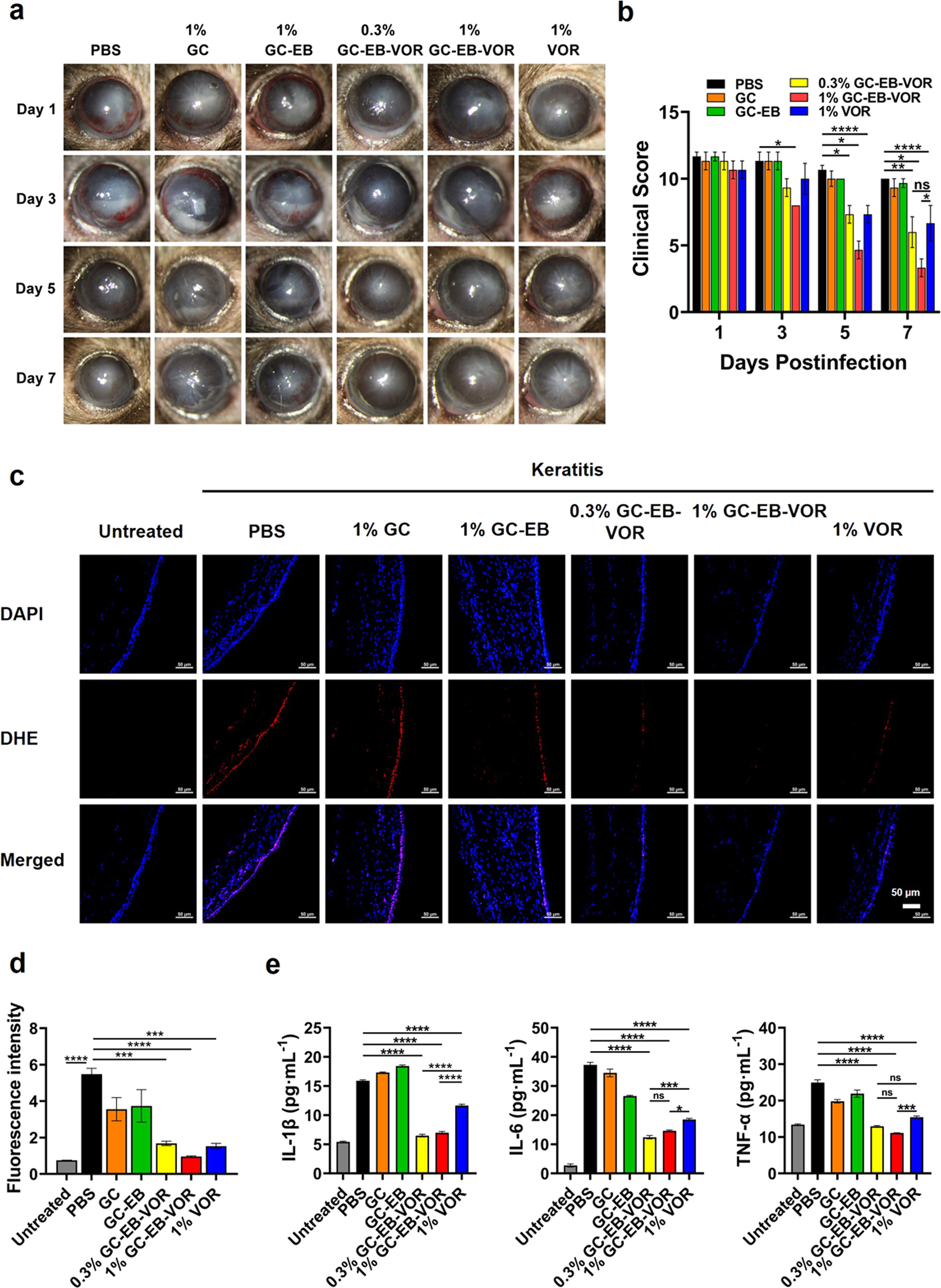 Fig. 5: In vivo therapeutic efficacy of GC-EB-VOR eye drops in a mouse model with fungal keratitis.