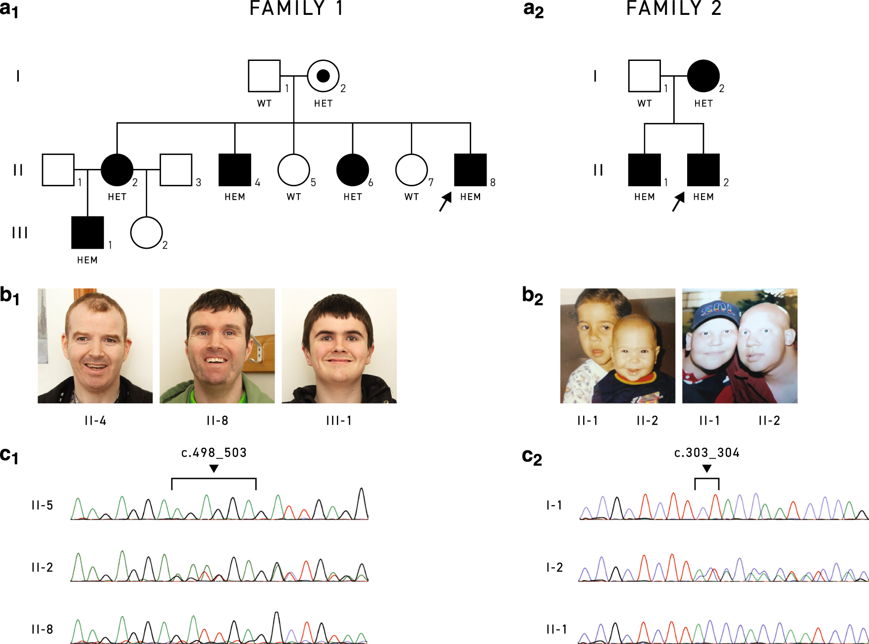Novel clinical and genetic insight into CXorf56-associated intellectual  disability | European Journal of Human Genetics