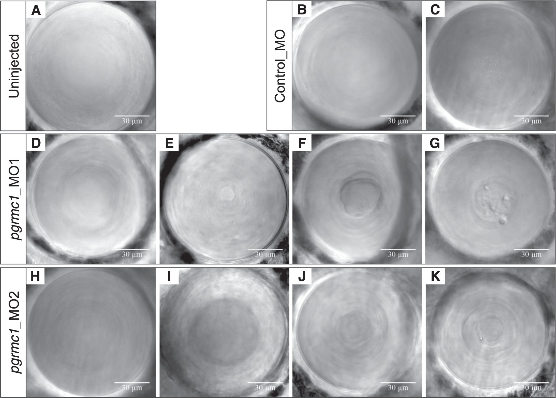 Fig. 4: Zebrafish pgrmc1 morpholino-induced knockdown lens phenotypes.