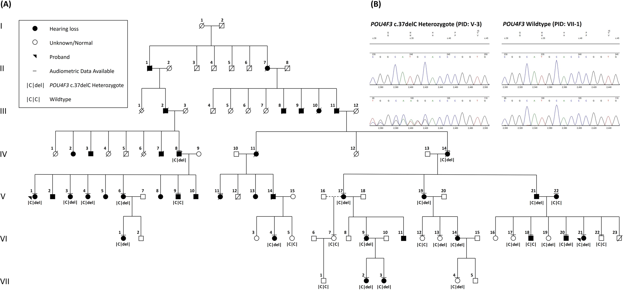 Fig. 1: Pedigree of a North American kindred, initially recruited as two independent families (probands PID V-1, VI-21) showing co-segregation of a novel pathogenic POU4F3 (c.37del) variant and autosomal dominant sensorineural hearing loss.
