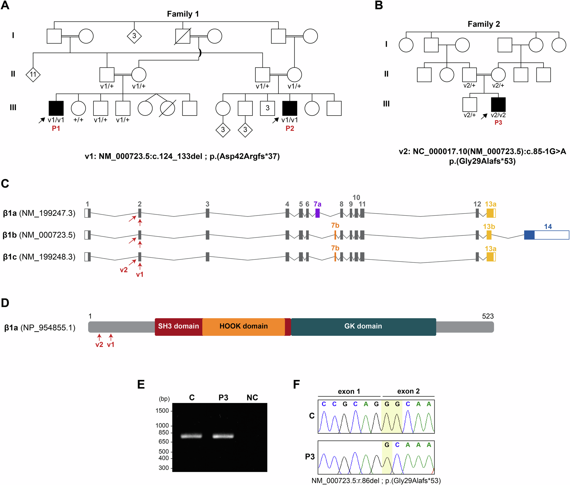 N-terminal truncating variants in CACNB1 cause a new congenital muscular  disorder | European Journal of Human Genetics
