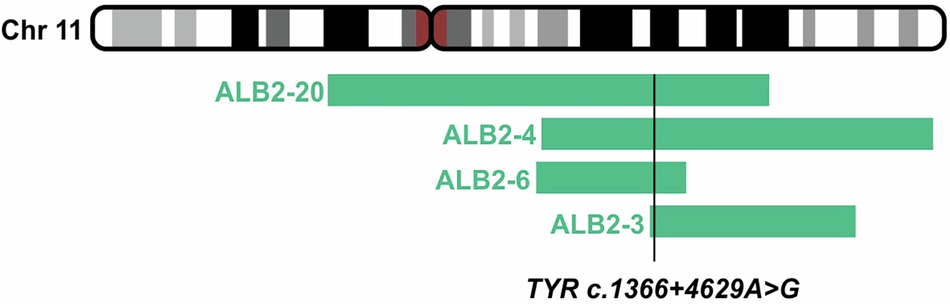 Oculocutaneous albinism variants in 28 consanguineous families and functional classification of a pathogenic deep intron variant in TYR
