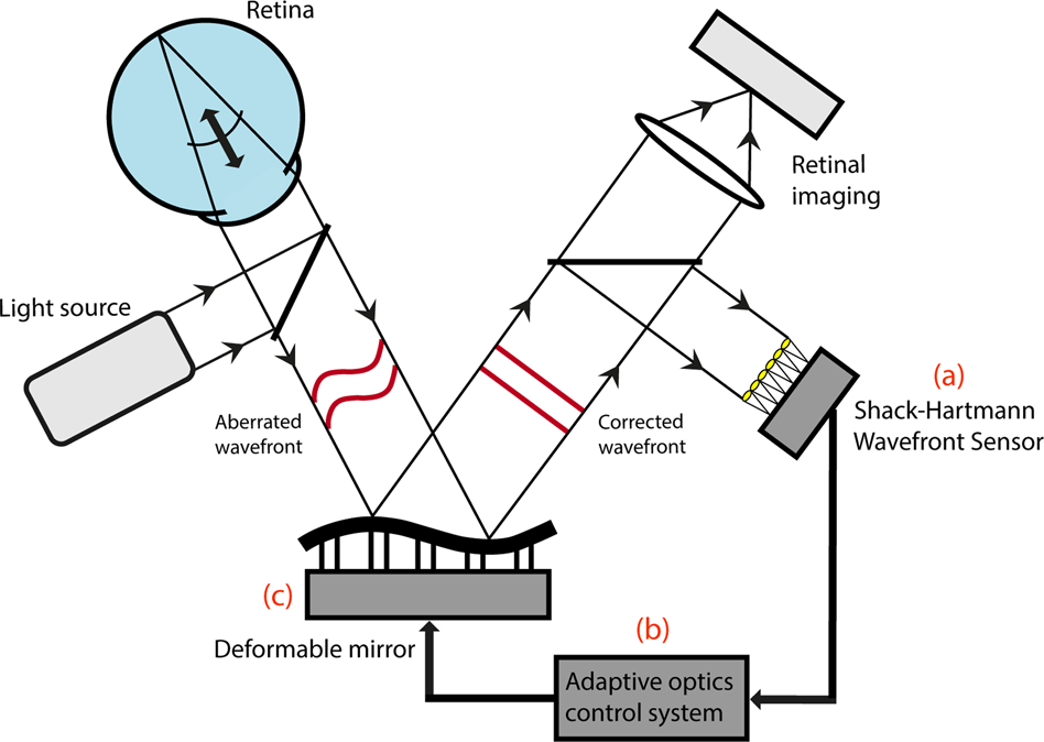 Cellular Imaging Of Inherited Retinal Diseases Using Adaptive Optics | Eye Cellular Imaging Of Inherited Retinal Diseases Using Adaptive Optics | Eye