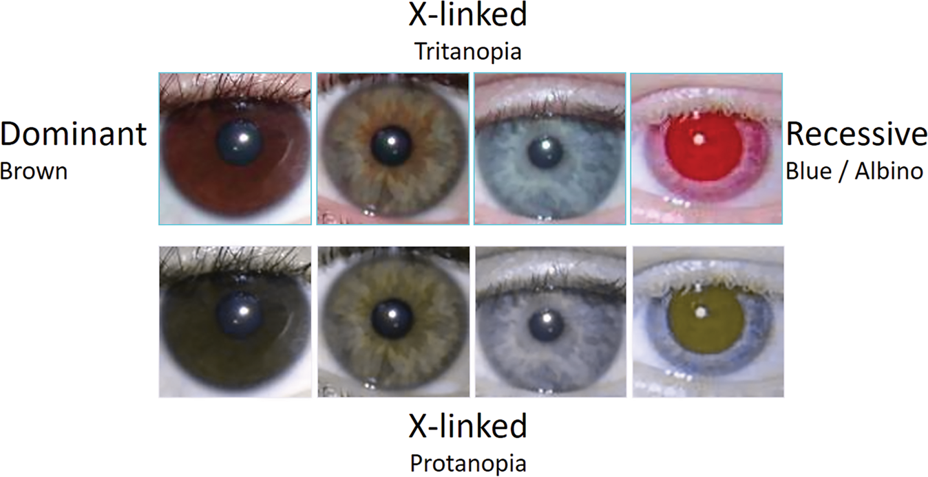 What colour are your eyes? Teaching the genetics of eye colour & colour  vision. Edridge Green Lecture RCOphth Annual Congress Glasgow May 2019 | Eye