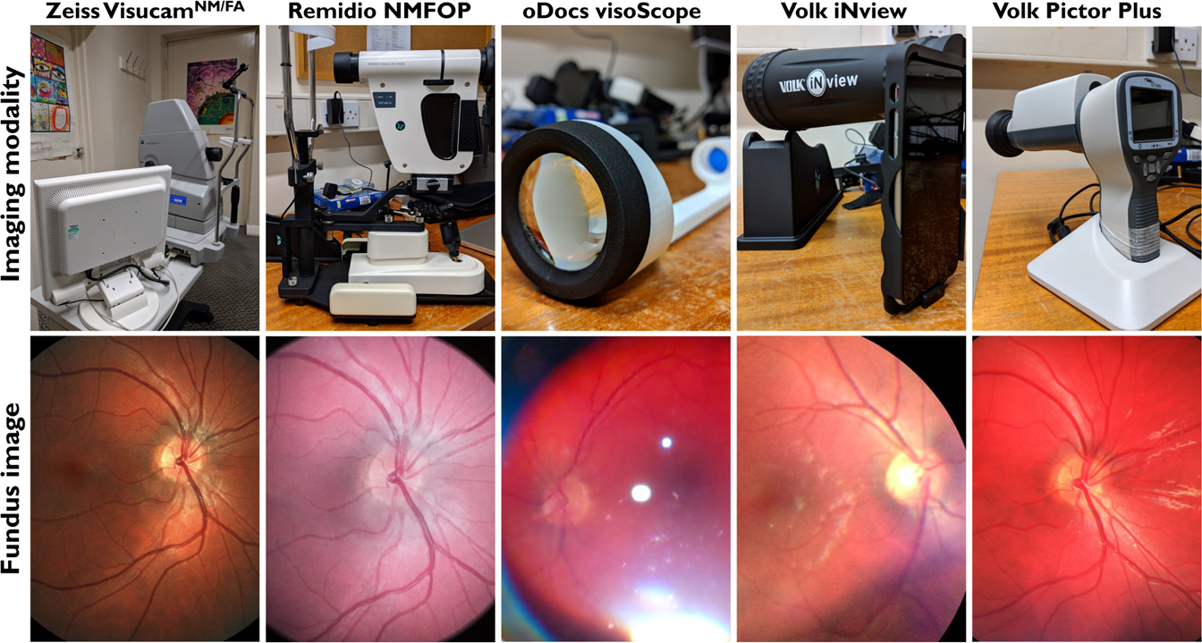 Feasibility and clinical utility of handheld fundus cameras for retinal  imaging | Eye