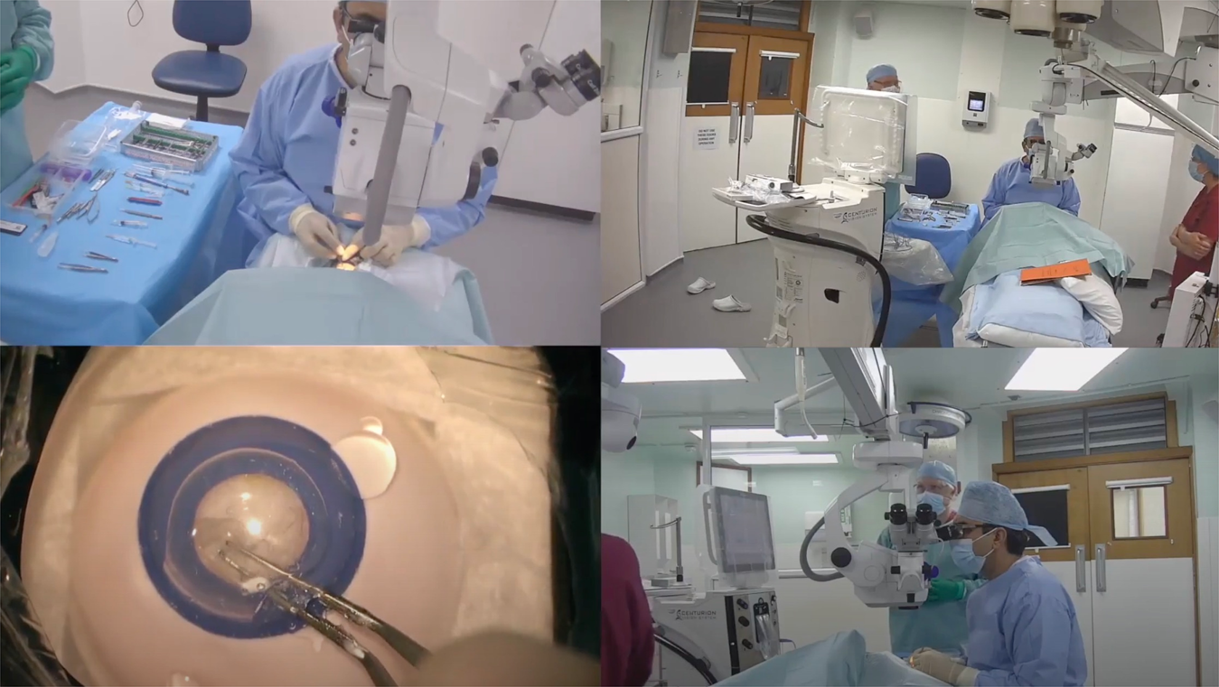 Non-technical skills simulation-based training model for managing intraoperative posterior capsule rupture during cataract surgery | Eye Non-technical skills simulation-based training model for managing intraoperative posterior capsule rupture during cataract surgery | Eye