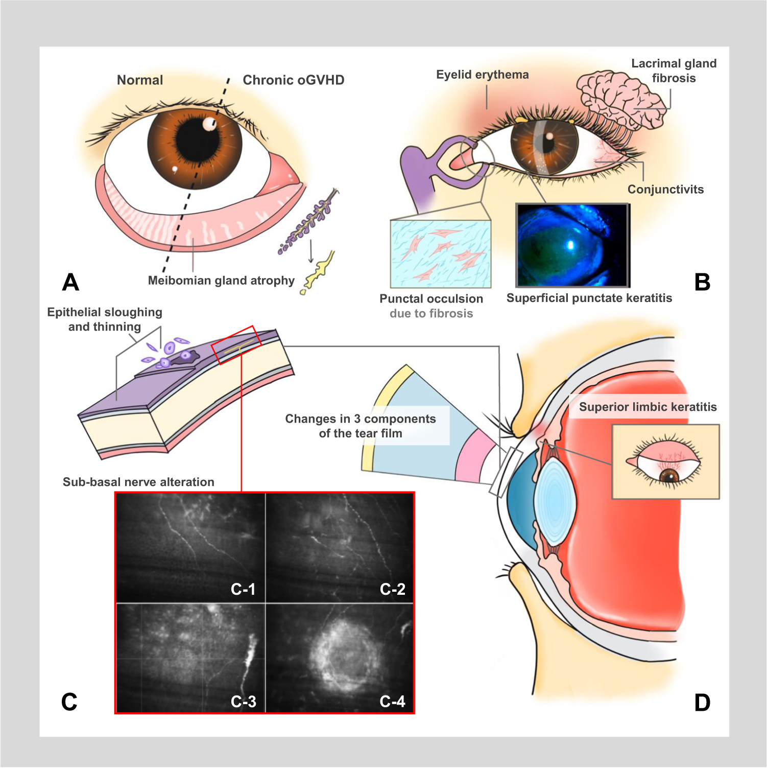 Read Insights about The Importance of Tears from Auckland Eye