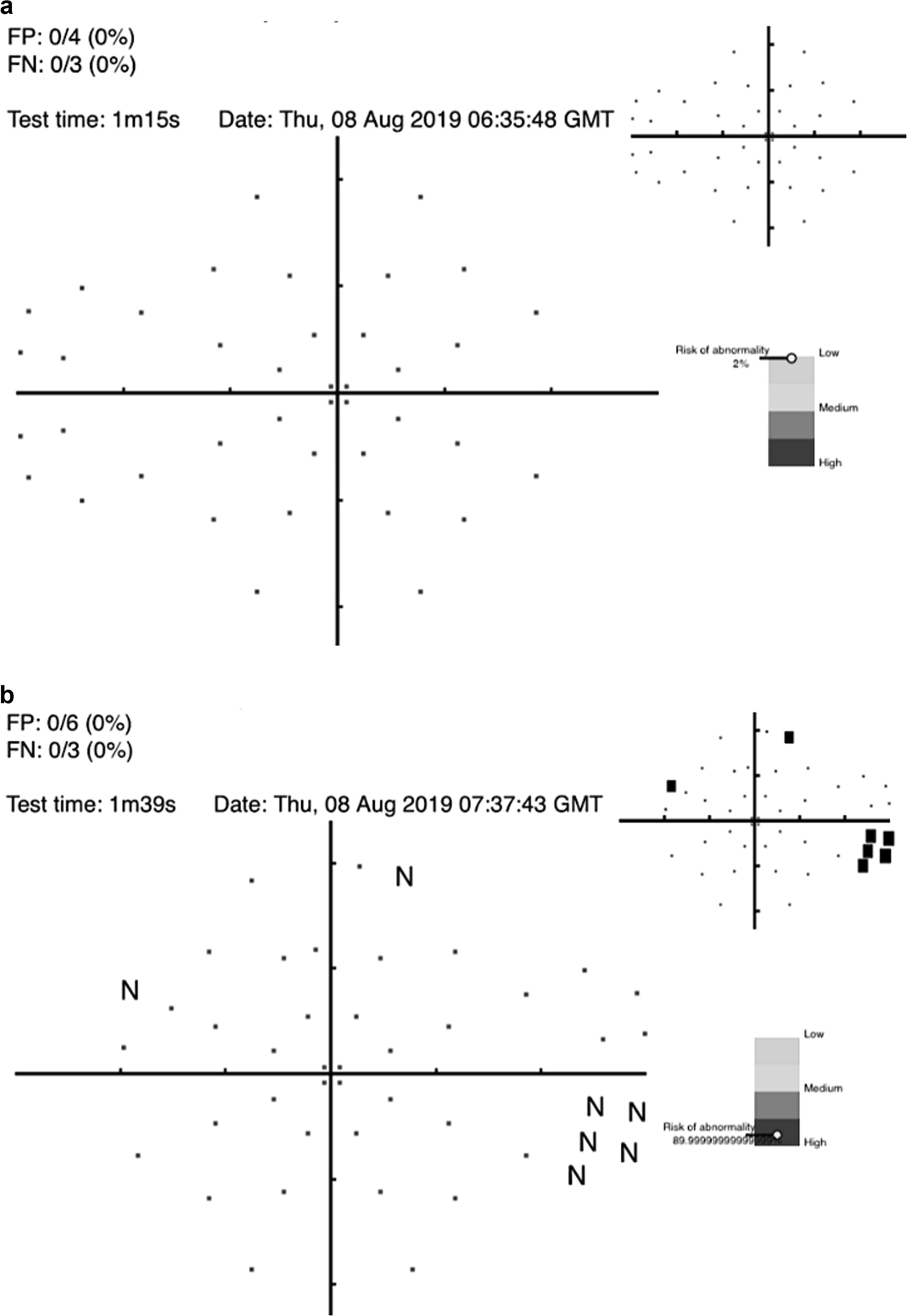 Fig. 4: An example of visual field screening.