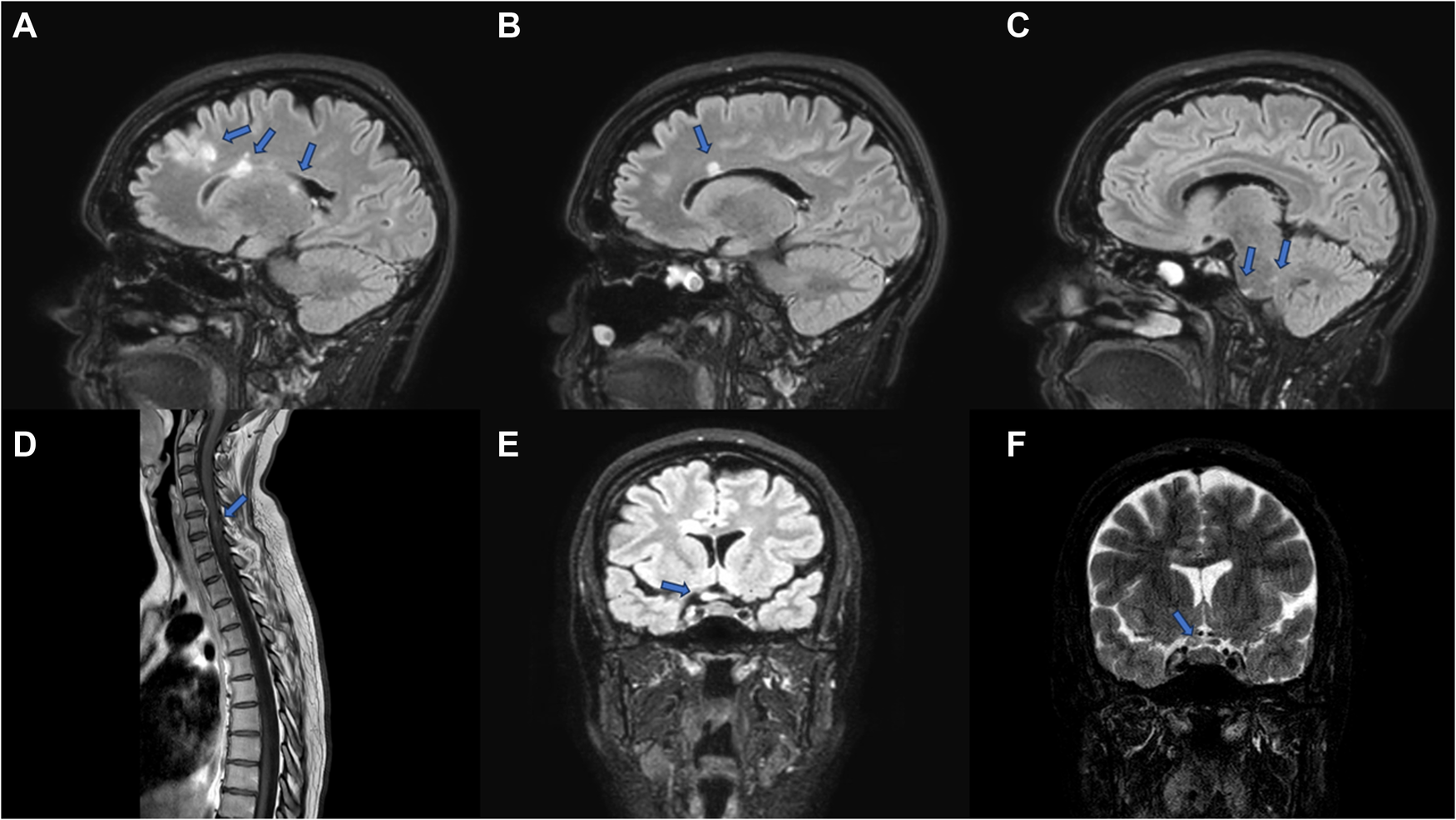Imaging the brain: diagnosis aided by structural features on neuroimaging studies | Eye
