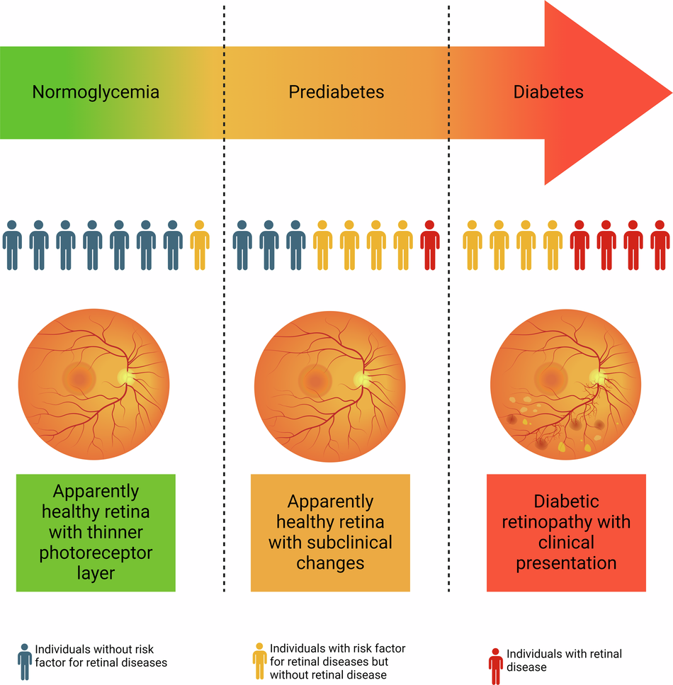 A new population for primary prevention of retinal diseases; a ...