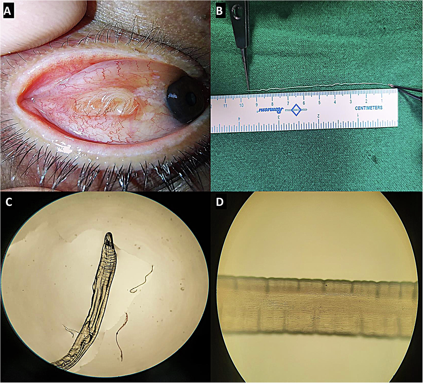 41433 2025 3967 Fig1 HTML