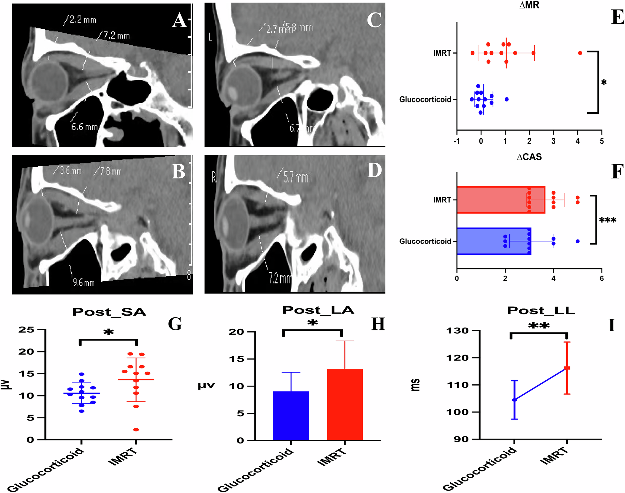 Long-term optic nerve safety of low-dose IMRT versus glucocorticoids in thyroid eye disease: an 8-year multimodal age-adjusted study