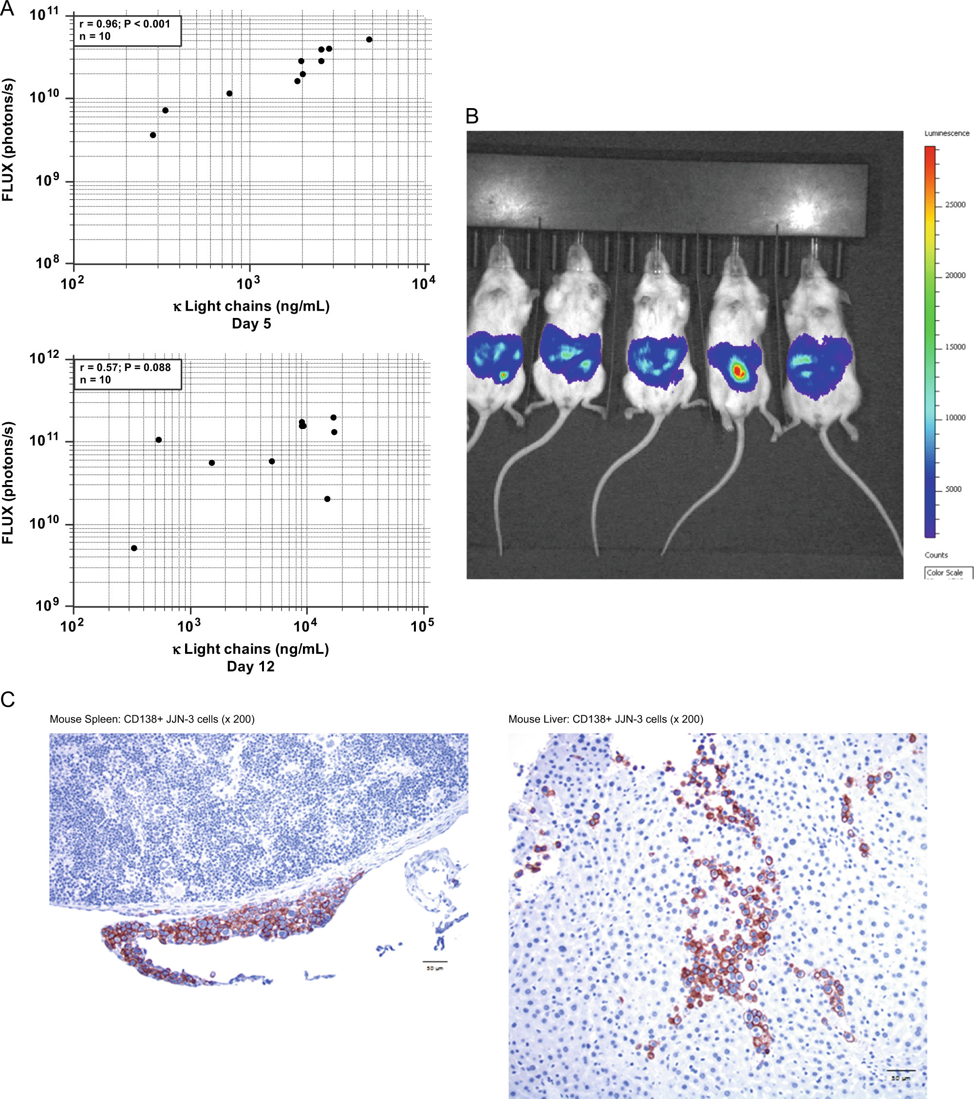 A novel xenograft mouse model for testing approaches targeting human kappa  light-chain diseases | Gene Therapy