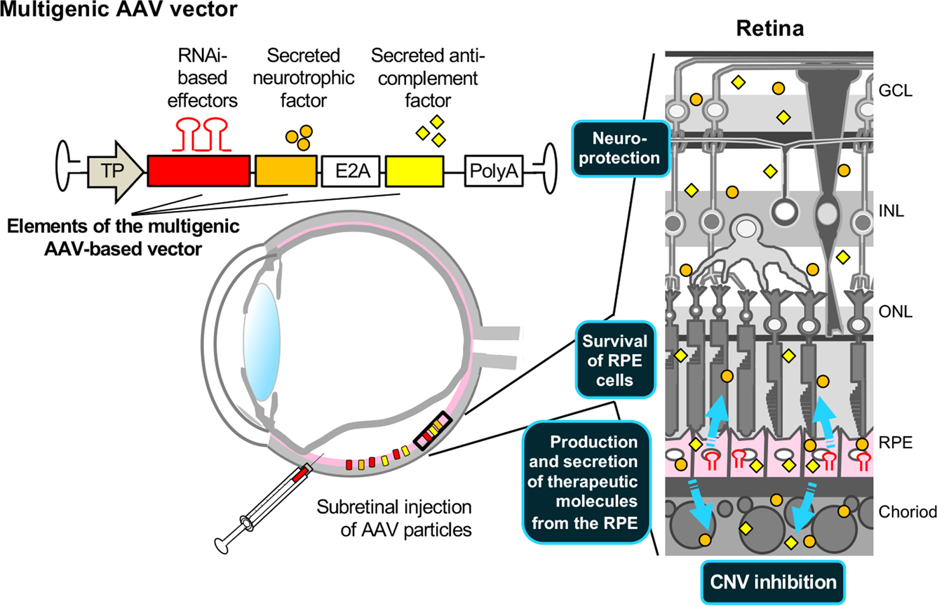 Retina - Gene Vision