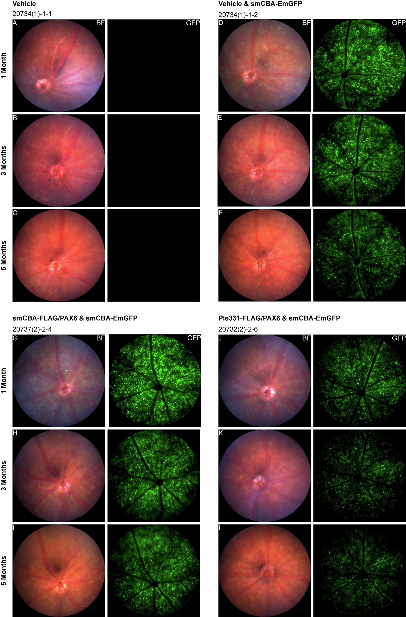 Fig. 2: Fundus longitudinal in vivo imaging of GFP expression revealed widespread viral transduction in the retina.