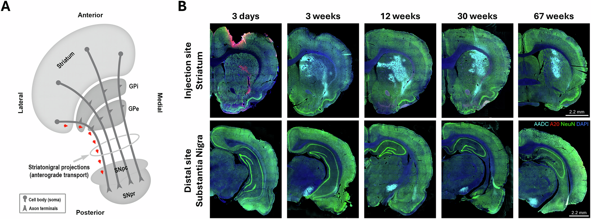 AAV2 capsid clearance and neuronal trafficking dynamics in the 