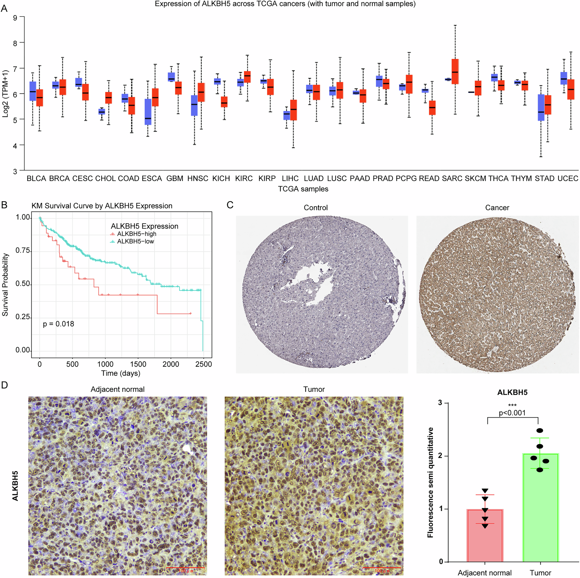 Fig. 3: High ALKBH5 expression correlates with poor prognosis and is upregulated in HCC tissues.