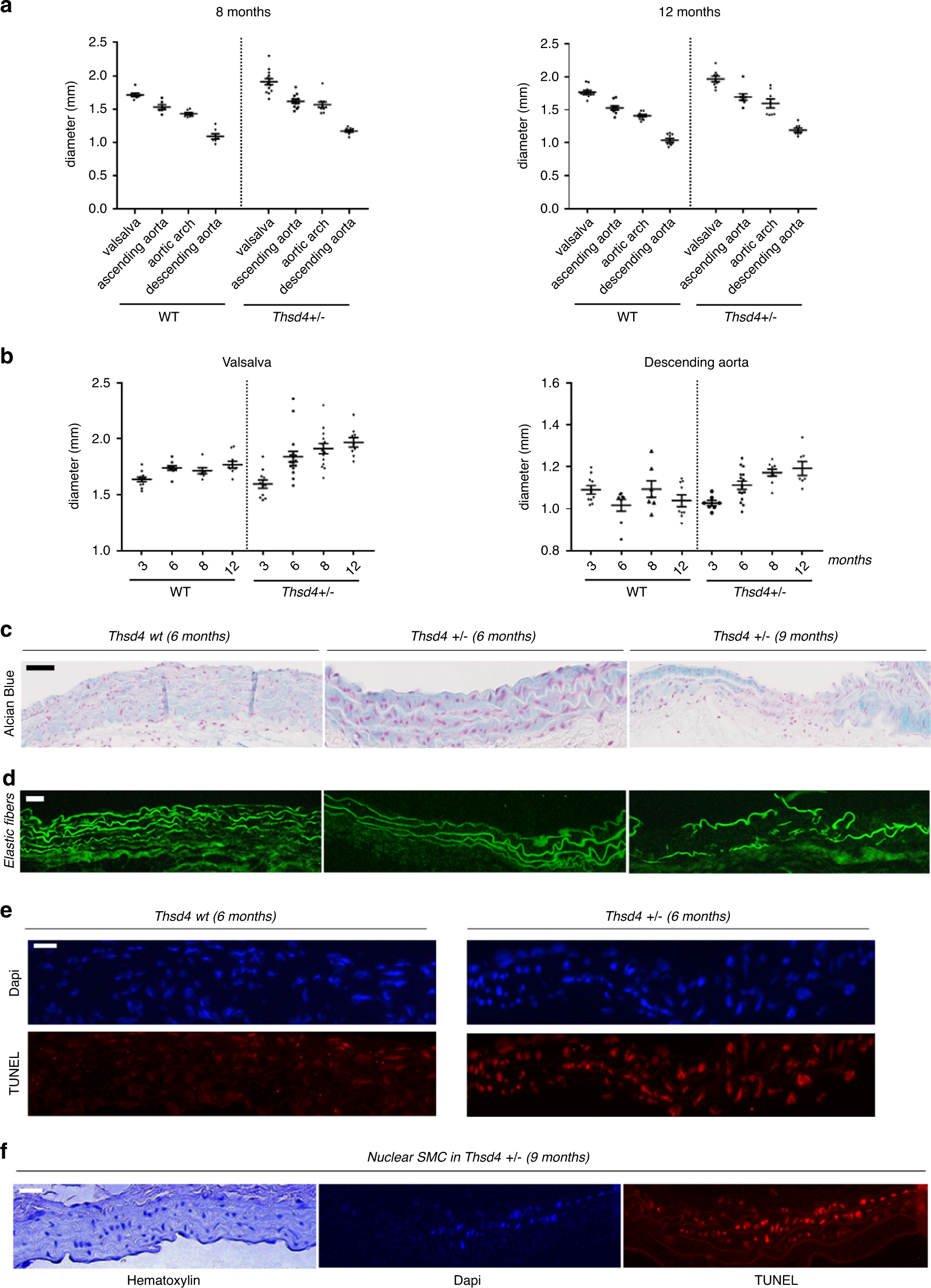 Fig. 4: Thsd4 deficiency induces aortic dilation.