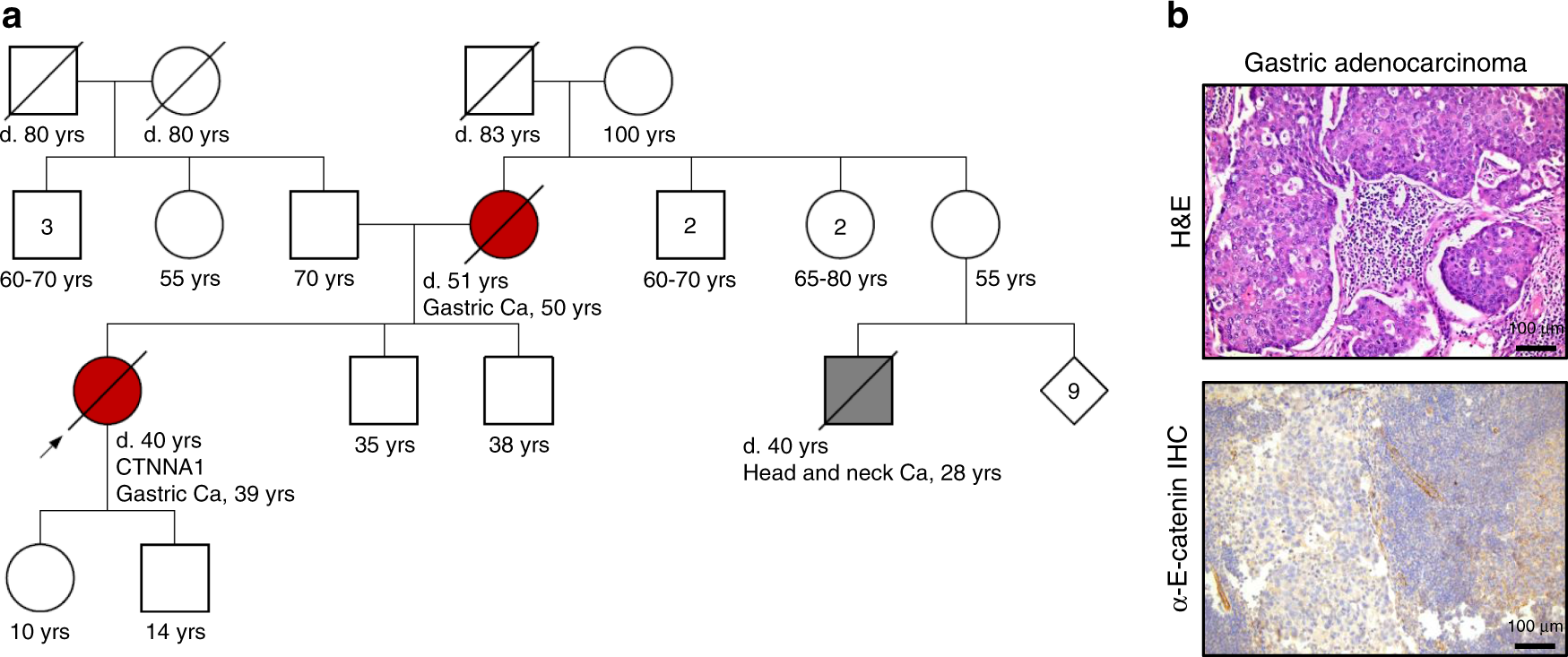 Fig. 3: CTNNA1 family 14.