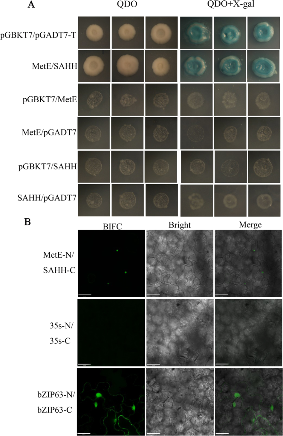 Fig. 3: Detection of protein–protein interaction between MetE and SAHH.
