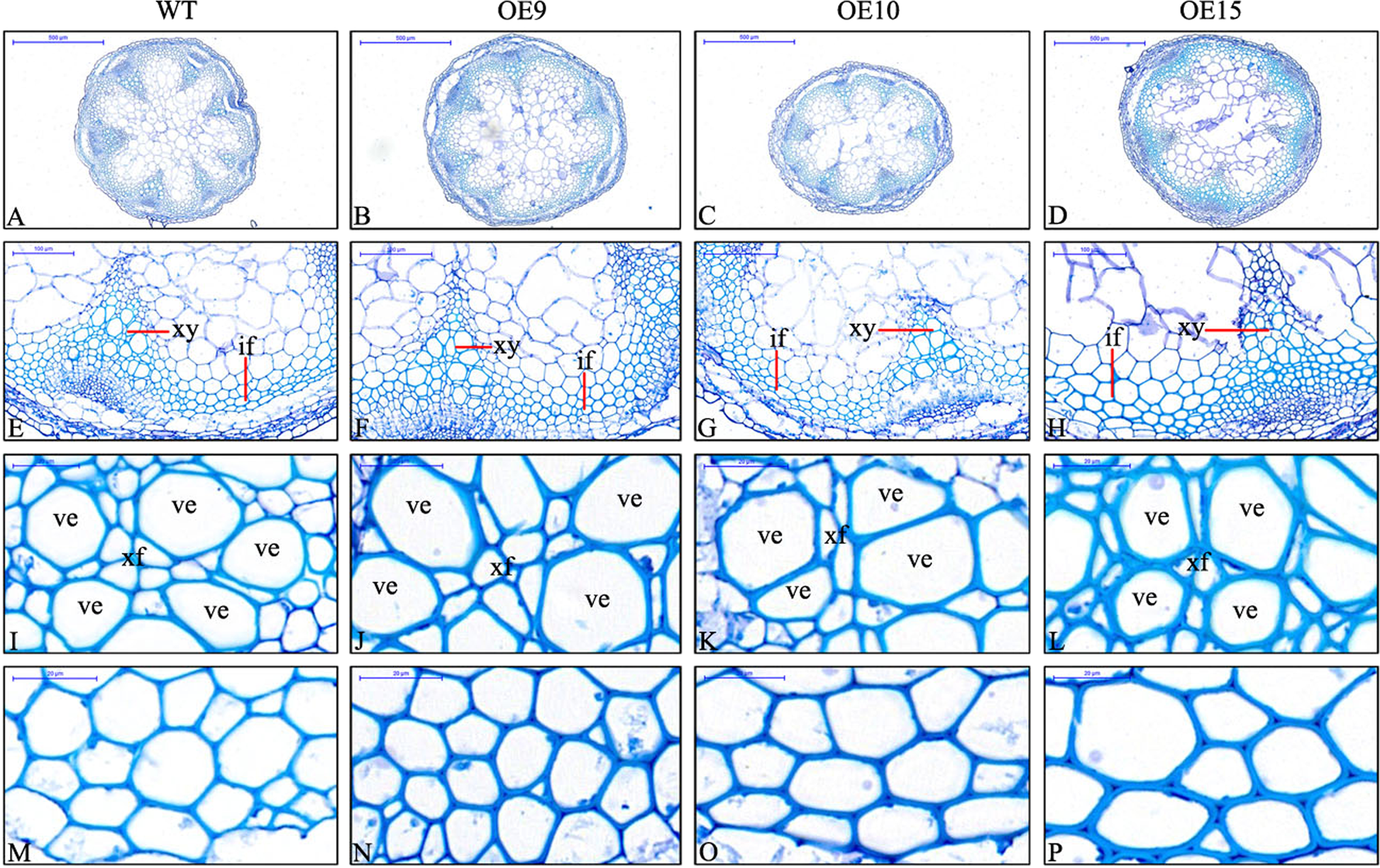 Fig. 5: Sections stained with toluidine blue, showing the variation of cell walls in Arabidopsis with PbMC1a/1b overexpression.