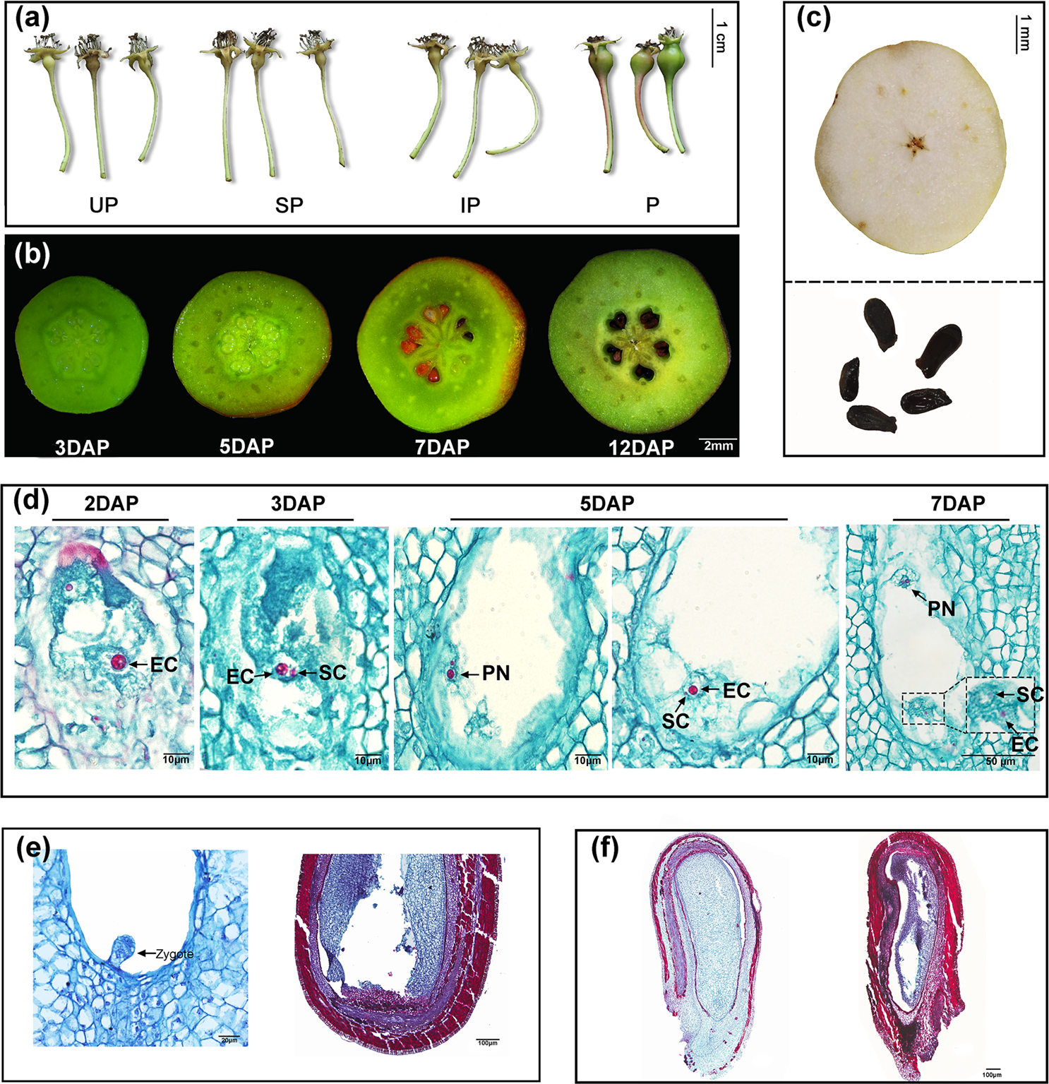 In Vitro Culture de l'ovule pour vivre-cellule d'imagerie du Zygote  polarisation et structuration d'embryon chez Arabidopsis thaliana