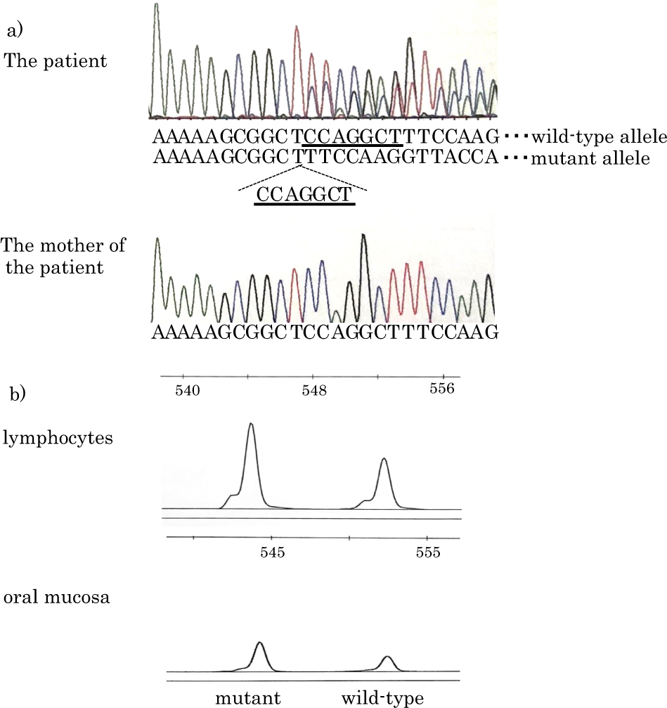Transiently Reduced Activity of Carbamyl Phosphate Synthetase and Ornithine  Transcarbamylase in Liver of Children with Reye's Syndrome | New England  Journal of Medicine, image size:949x1007