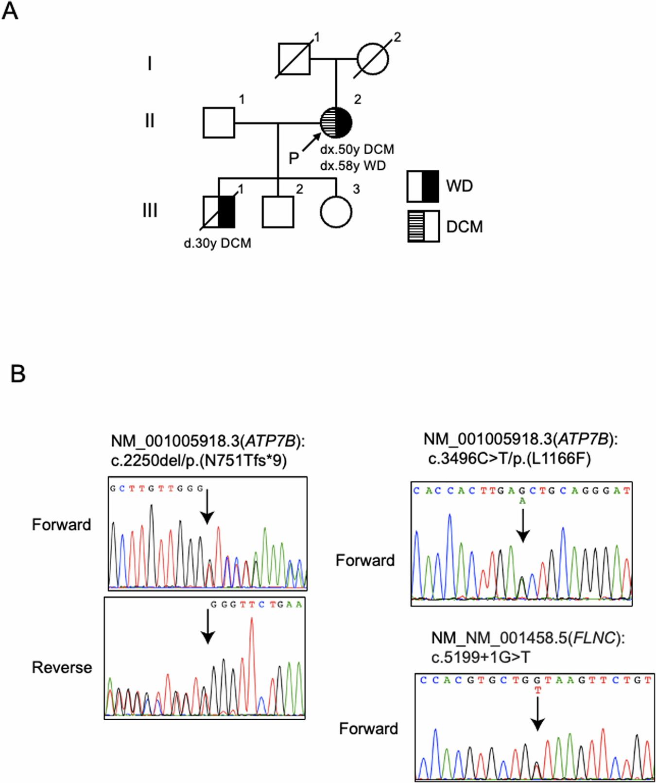 Fig. 2: Family pedigree of the patient and Sanger sequencing electrophoretograms.