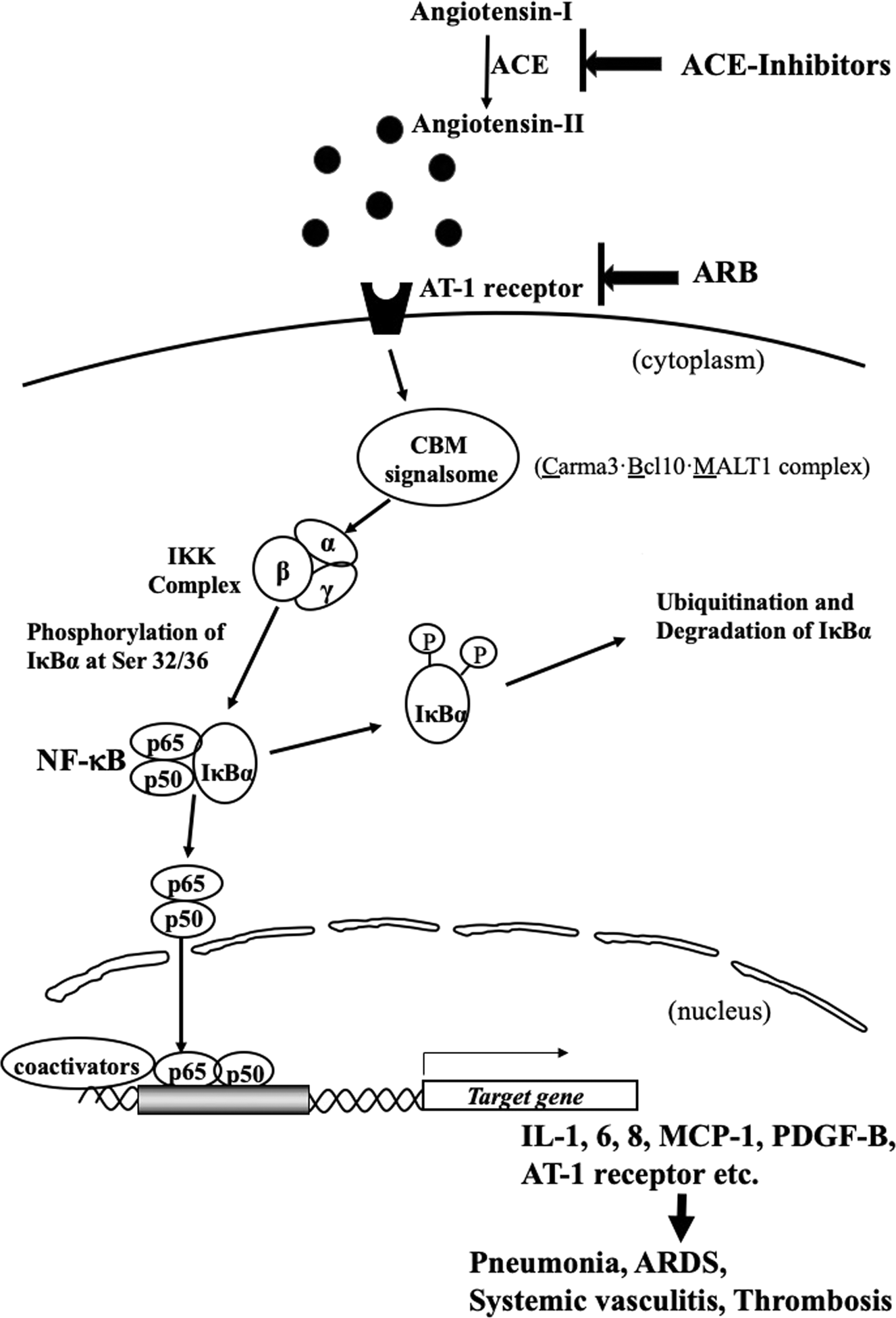 manipulere Ønske Træ The pivotal role of the angiotensin-II–NF-κB axis in the development of  COVID-19 pathophysiology | Hypertension Research