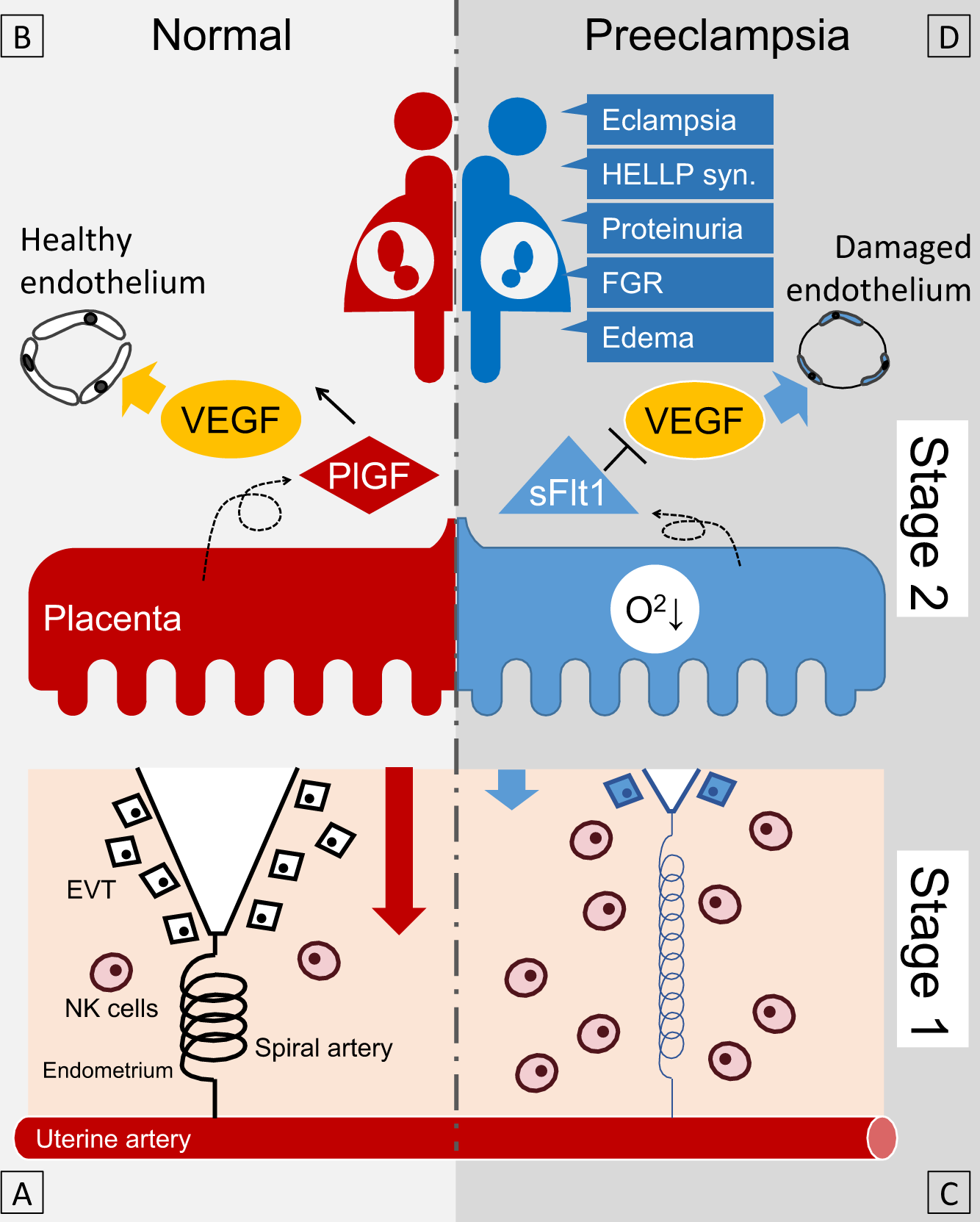 Toxemia: What Is It, How It Is Managed, and More