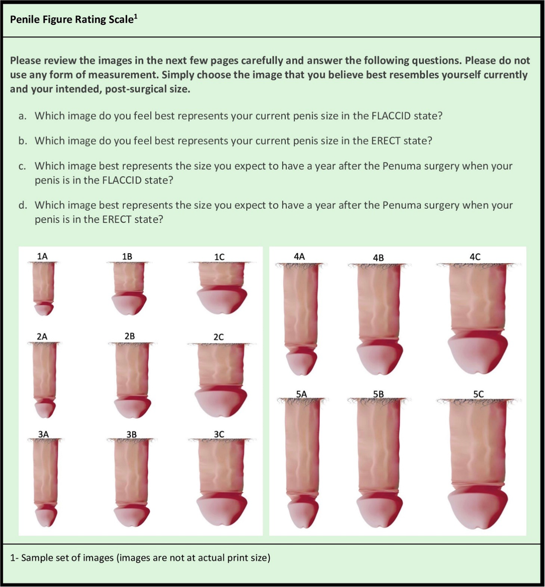 Patient selection protocol for the Penuma® implant: suggested preoperative  evaluation for aesthetic surgery of the penis | International Journal of  Impotence Research