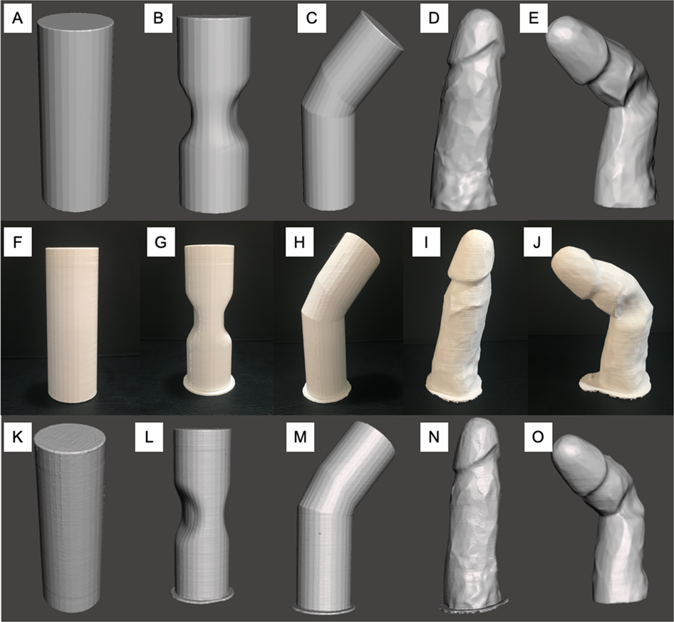 3D-printed phantoms to quantify accuracy and variability of goniometric and volumetric assessment of Peyronies disease deformities International Journal of Impotence Research
