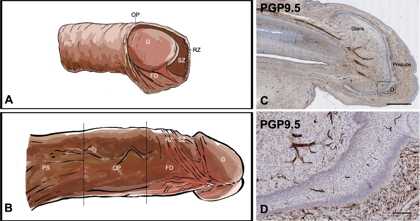 Immunohistological study of the density and distribution of human penile  neural tissue: gradient hypothesis | International Journal of Impotence  Research