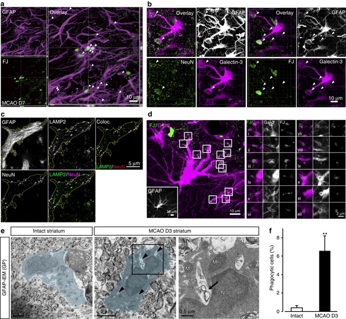 Stroke subtype-dependent synapse elimination by reactive gliosis in mice