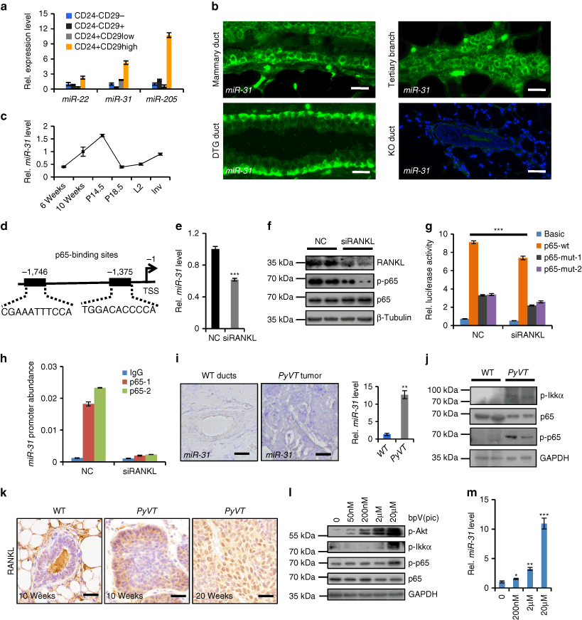 MiR-31 promotes mammary stem cell expansion and breast tumorigenesis by  suppressing Wnt signaling antagonists