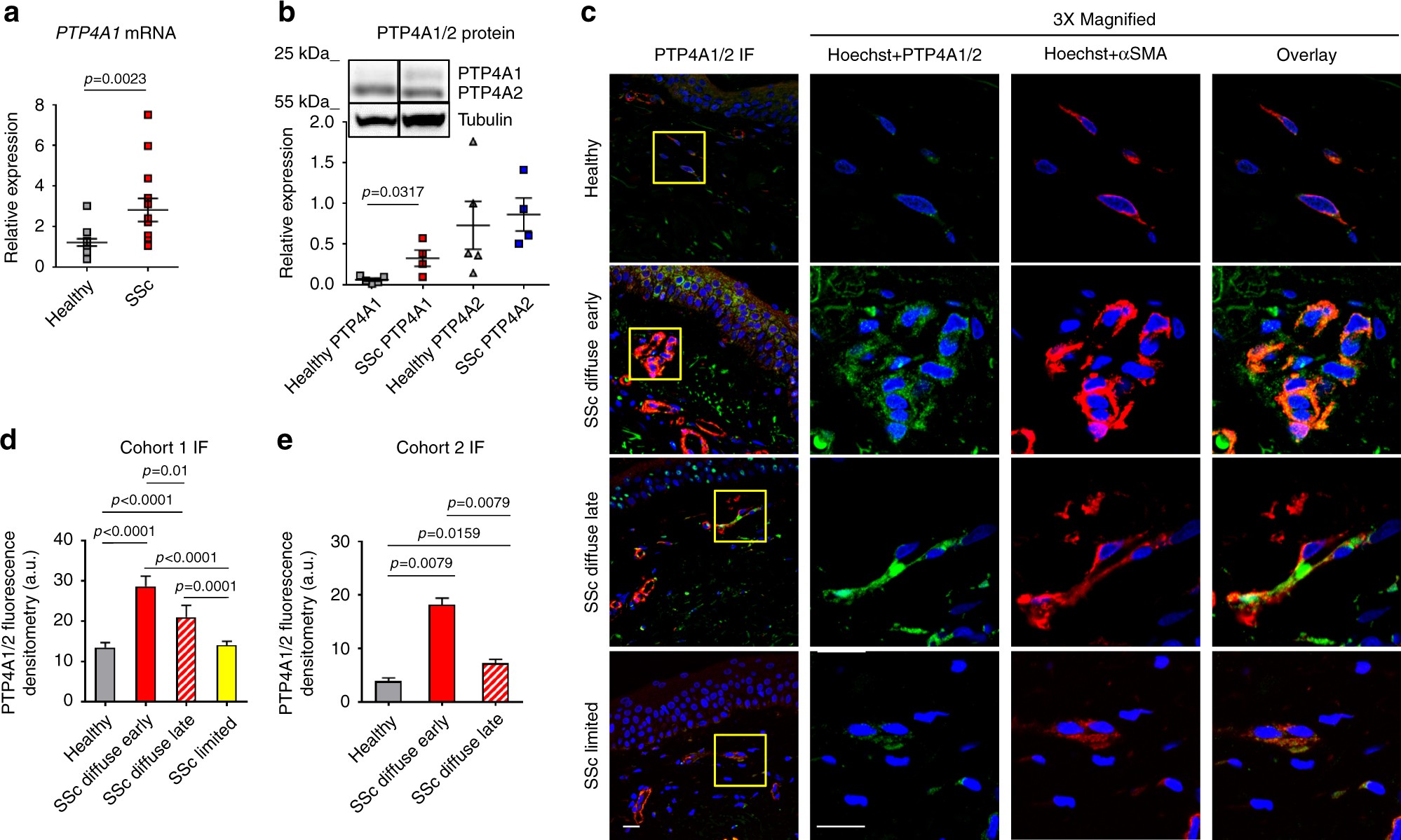 PTP4A1 promotes TGFβ signaling and fibrosis in systemic sclerosis ...