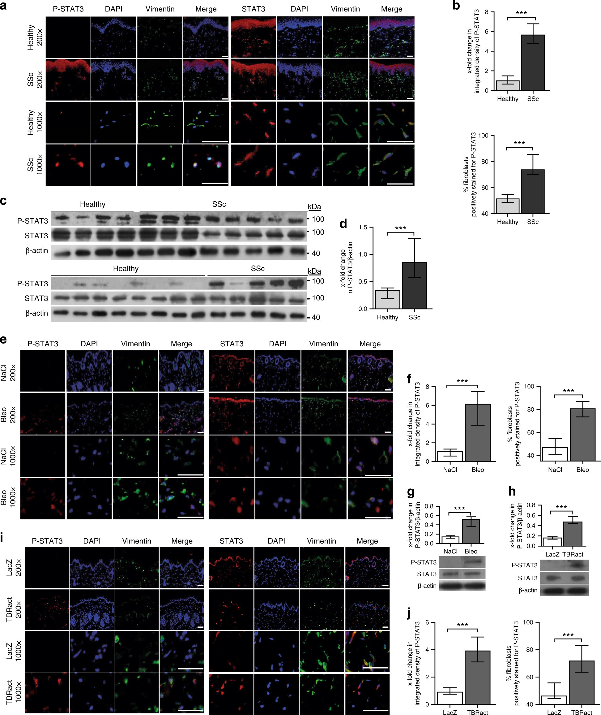 Activation of STAT3 integrates common profibrotic pathways to promote  fibroblast activation and tissue fibrosis | Nature Communications